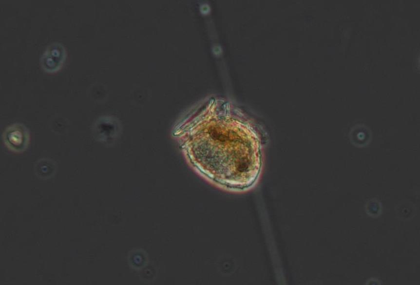 Photographie d'une cellule de phytoplancton