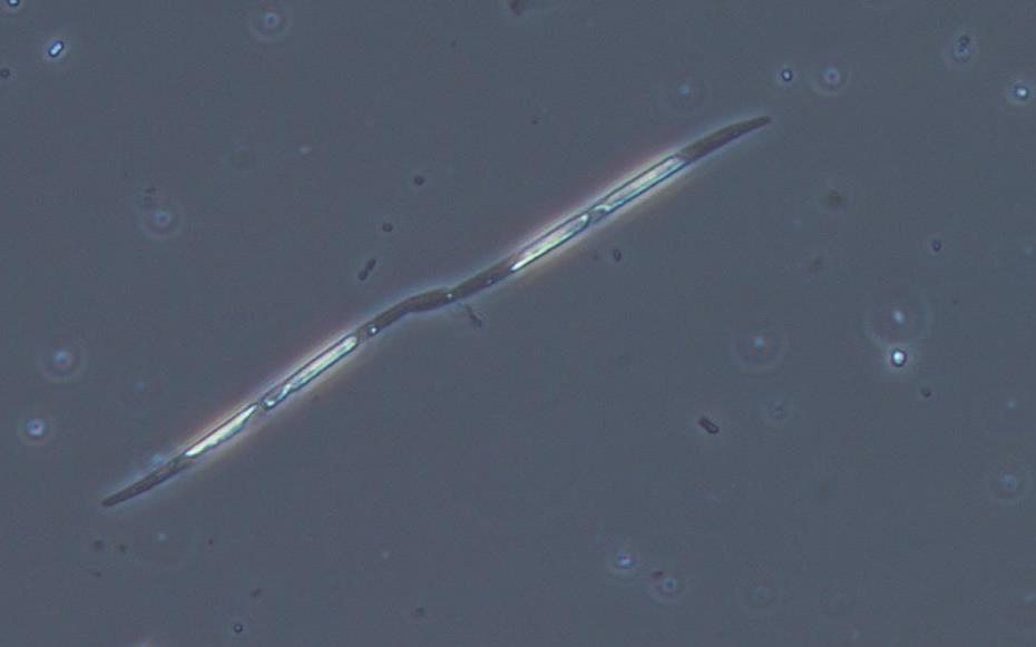 Pseudo-Nitzschia