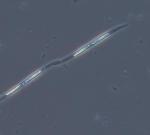 photo de plancton au microscope