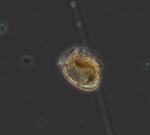 Photographie d'une cellule de phytoplancton