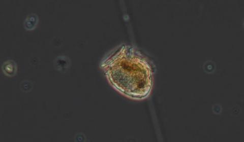 Phytoplancton Photographie d'une cellule de phytoplancton