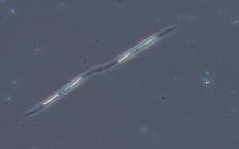 photo de plancton au microscope